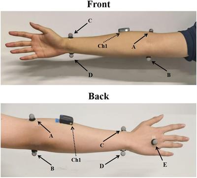 A Co-driven Functional Electrical Stimulation Control Strategy by Dynamic Surface Electromyography and Joint Angle